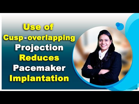 Cusp overlapping projection in TAVR reduces rate of permanent pacemaker implantation