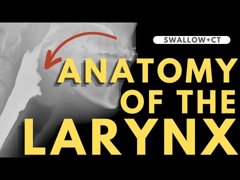 Larynx Anatomy | Radiology anatomy part 1 prep | CT interpretation