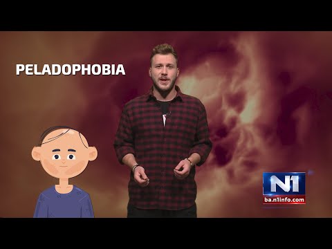 Strah od ćelavih ljudi, svekrve, posla: Rijetke fobije za koje vjerovatno niste čuli