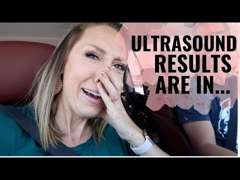 ULTRASOUND RESULTS ARE IN... SHOCK OF A LIFETIME! Video