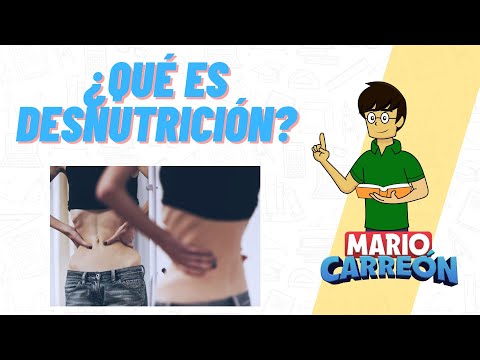 ¿Qué es la desnutrición?