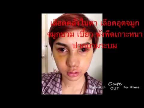 คลิกเพื่อดูคลิปวิดีโอ