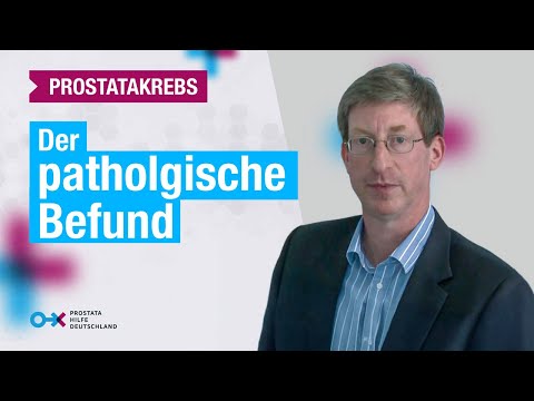 Kerzen von Hämorrhoiden für Prostata Abtasten Prostatasekreten