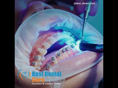 Best Dental Treatment