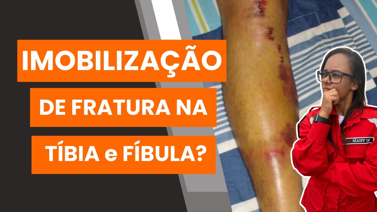 Você sabe fazer uma IMOBILIZAÇÃO de FRATURA na TÍBIA e FÍBULA? 🏥💪