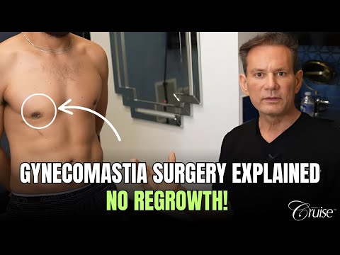 Will Gyno Return - Gynecomastia Specialist in Newport Beach Answers