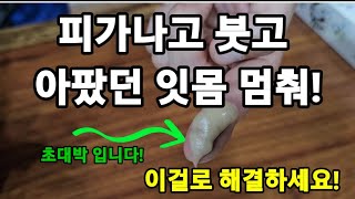 잇몸에서 피가나고 붓고 시려서 힘든분들 이거! 진짜 초대박!입니다! #잇몸에좋은치약 #잇몸아플때 #잇몸좋게하…