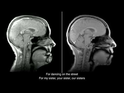 Ultra-rapid anatomical MRI processing: speaking / singing