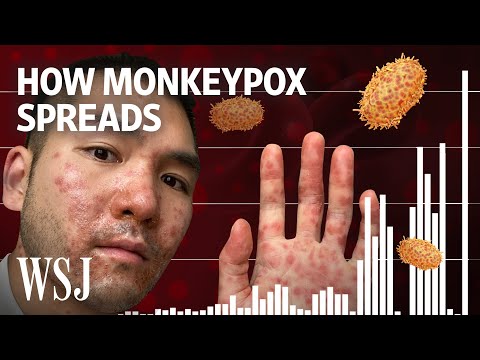 , title : 'Why Monkeypox Is a Global Health Threat | WSJ'