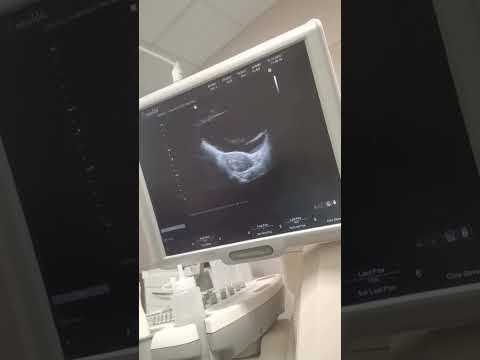 Moshe Ndiki is having twins| Congratulations to soon-2-be Tata❤💞 si lapha ngawe