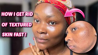 HOW I GET RID OF TEXTURED SKIN ON MY FACE FAST !  | Affordable products that actually work