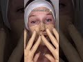 Meredith Duxbury Viral Foundation