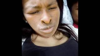 Tua sebelum waktunya