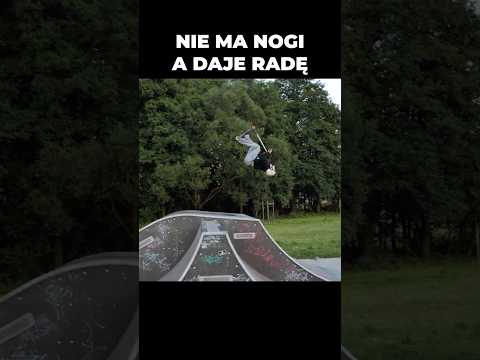 On nie ma nogi a daje radę