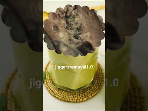 Jiggers Digging