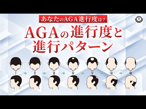 トウヒについて詳しく解説