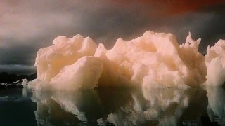 Mini Dresses - Bracelets