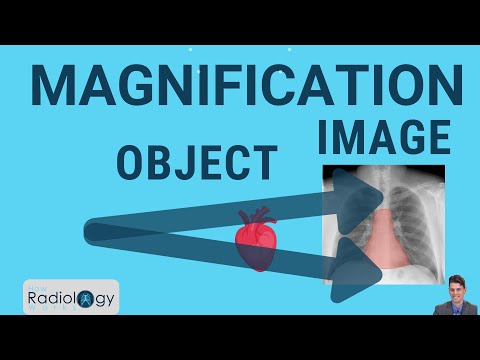 image-Which type of mammography is best?
