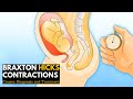 Braxton Hicks Contractions Causes Signs And Symptoms Diagnosis And Treatment