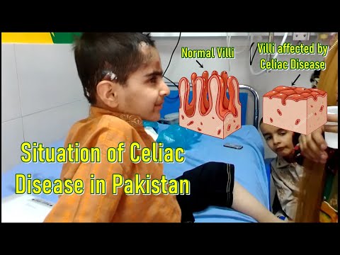 Celiac Disease increasing in Pakistan | Signs,...