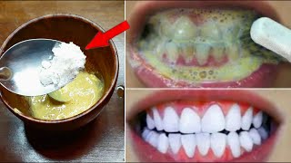 Teeth whitening at home in 3 minutes || How to naturally whiten your yellow teeth || 100% effective