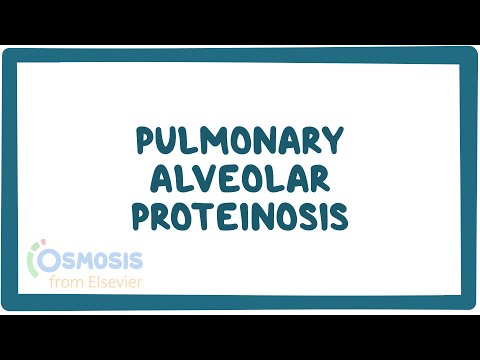 Pulmonary Alveolar Proteinosis, PAP (NORD)