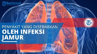 Aspergilosis, Penyakit yang Disebabkan oleh Infeksi Jamur Aspergillus