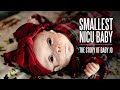 Smallest NICU Baby The Story Of Baby Jo