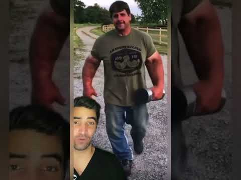 Overproduction of Growth Hormone