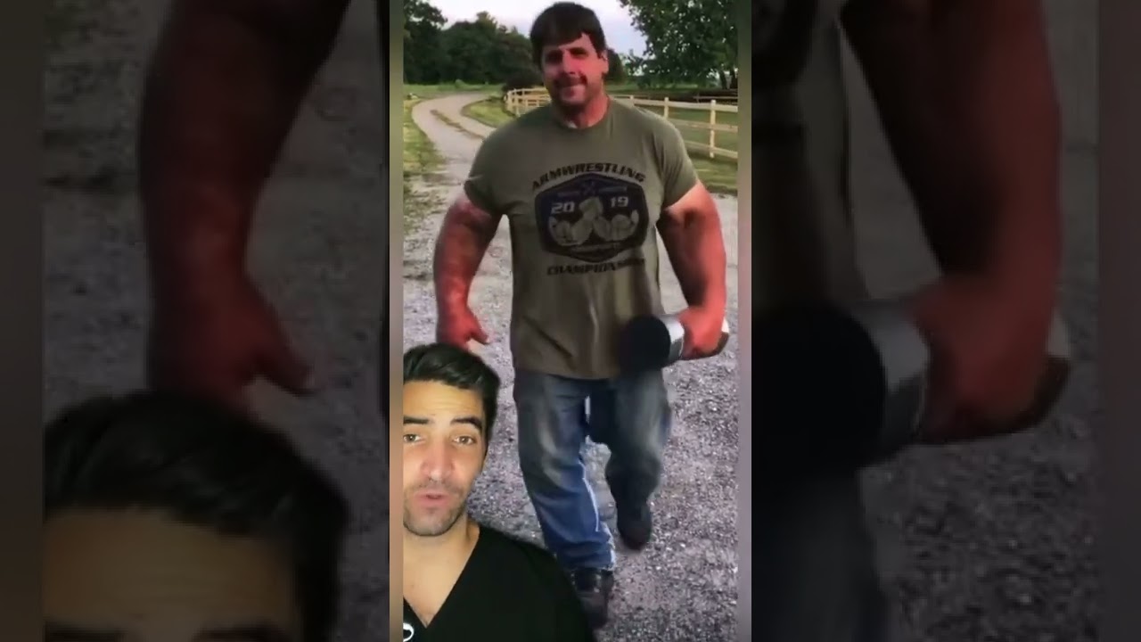 Produksi Hormon Pertumbuhan Berlebihan