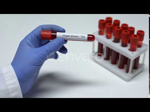 Chagas Disease, Doctor Shows Blood Sample in Tube, Lab Research, Health Checkup | Stock Footage ...