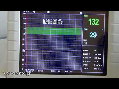 Contec Cms 800g Fetal Monitor