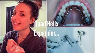 I Don’t Like This | Traditional Braces | App. 4