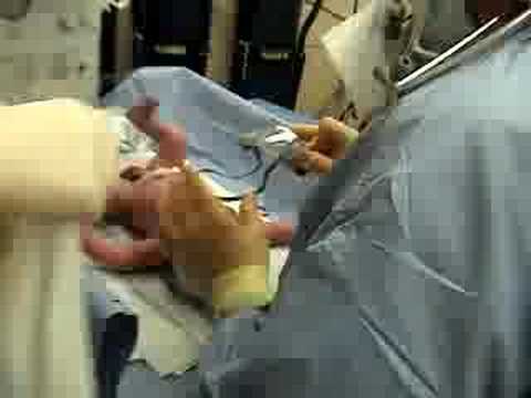 Nacimiento de Lorenzo