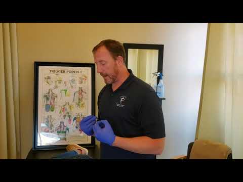 Dry Needling the Temporalis Muscle