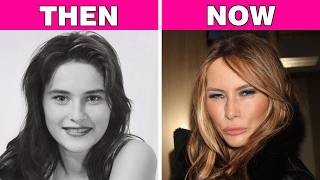 70+ Celebrity Transformations So Extreme Fans Are Worried | Then and Now!