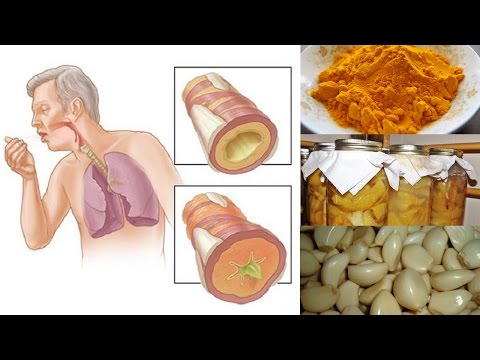 Osteochondrose des Zentrums von Sankt Petersburg Arthrose Behandlungsschema