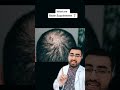 What Are Biotin Supplements Supplements To Stop Hair Loss