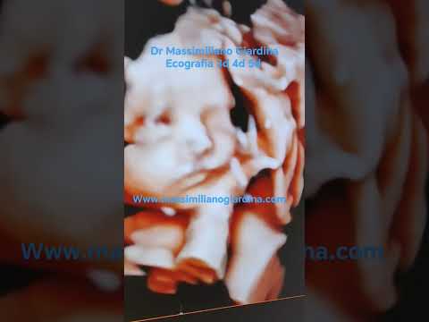 Massimiliano Giardina-5