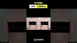  팔뚝살이 사라지니까 훨씬 가벼워 보임😳