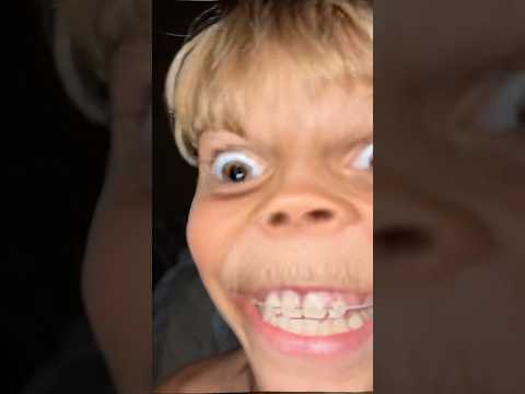 ‼️SHOCKING😱 Something happened to Tydus…. #jumpscare #funny #prank