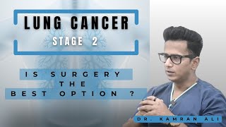 Stage 2 Lung Cancer