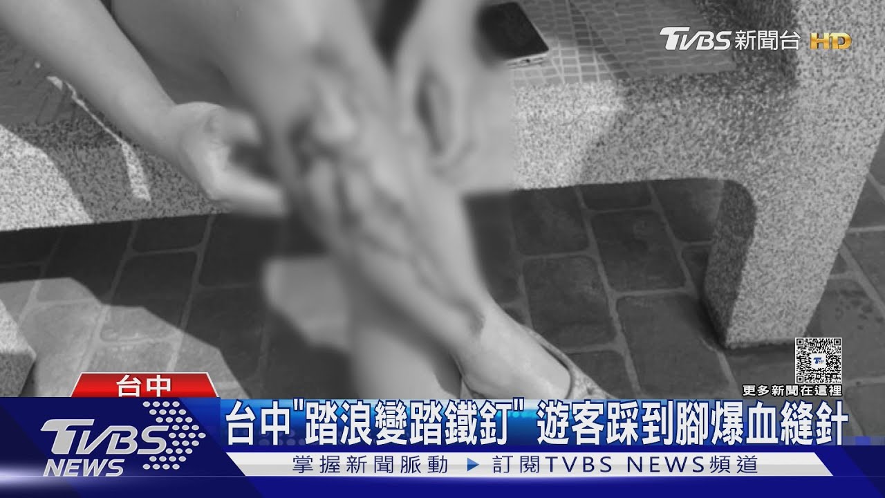 台中「踏浪變踏鐵釘」　遊客踩到腳爆血縫針