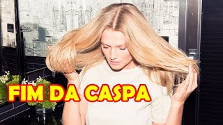 VOC NUNCA MAIS VAI TER CASPA DEPOIS DISSO