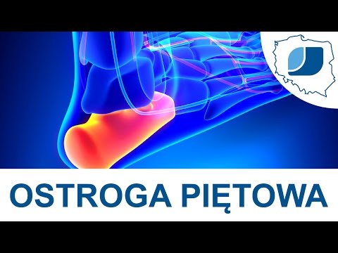 Koślawego płaskie ćwiczenia stóp Stanowisko koślawości stóp