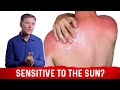Can You Be Allergic To The Sun Dr Berg On Sun Allergy And Niacin Deficiency