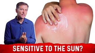 Can You Be Allergic to the Sun? – Dr.Berg on Sun Allergy and Niacin Deficiency