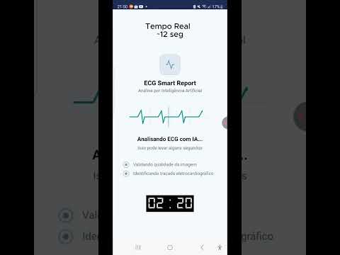 ECG Smart report