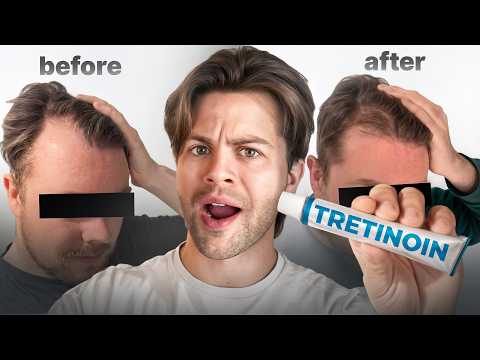 How to Use Tretinoin to Improve Minoxidil’s Results (Step-By-Step Guide)