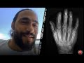 CATCHING UP WITH KEITH THURMAN "I BELIEVE MY HAND IS 100%!" TALKS LIFE IN SELF-QUARANTINE